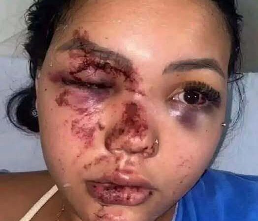 Mujer con graves lesiones en el rostro genera preocupación tras difundirse una denuncia en redes