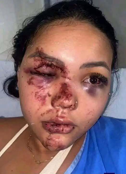 Mujer con graves lesiones en el rostro genera preocupación tras difundirse una denuncia en redes